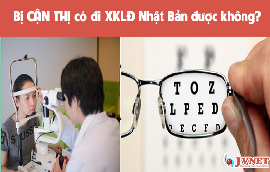 Bị cận thị có đi XKLĐ Nhật Bản được không?-1